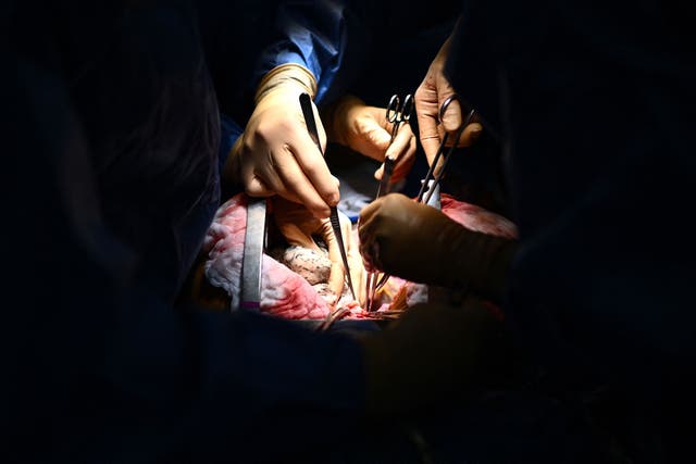 <p>In this picture taken on December 9, 2022, thoracic surgeon Thomas Charrier from the Foch hospital in Suresnes outside Paris, removes the lungs of a deceased patient before bringing them back to the Foch hospital for a transplantation to be performed later in the day, at an operating room in an undisclosed hospital in eastern France</p>